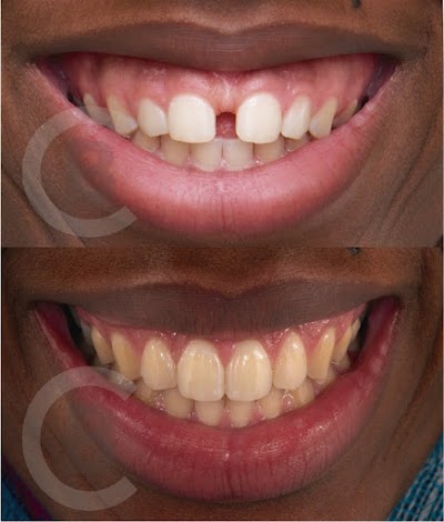 Clínica Dental BLASI 