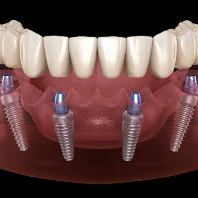 Clínica Dental CEID